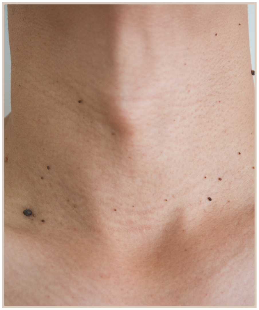 Image link